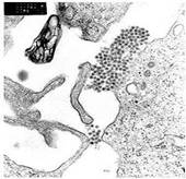 http://upload.wikimedia.org/wikipedia/commons/thumb/b/b0/Dengue.jpg/190px-Dengue.jpg